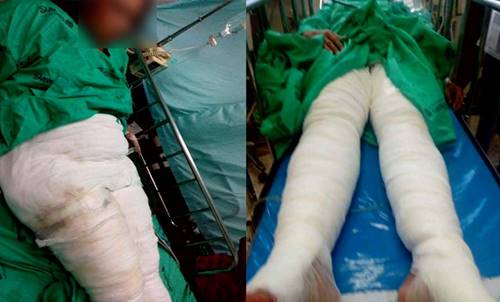 2 แม่ลูก อ้างไม่ได้ใช้น้ำร้อนราด