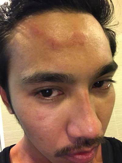 ใบเตย เพลงที่มีงู โดนปาน้ำแข็งใส่หน้า