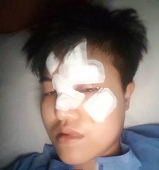  ดีเจทอมใช้แก้วทุบหน้าน้องบล็อกเกอร์