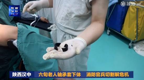 คลิปปฏิบัติการระทึก แพทย์-กู้ภัยระดมกำลังช่วยลุง หลังทำห่วงเหล็กติดเจ้าโลก