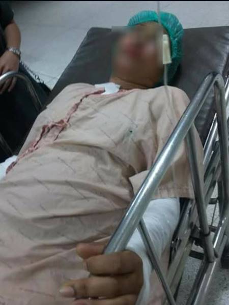 ดักสาดน้ำกรด