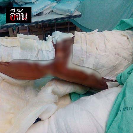 2 แม่ลูกเอาน้ำมันร้อน ๆ ราด 