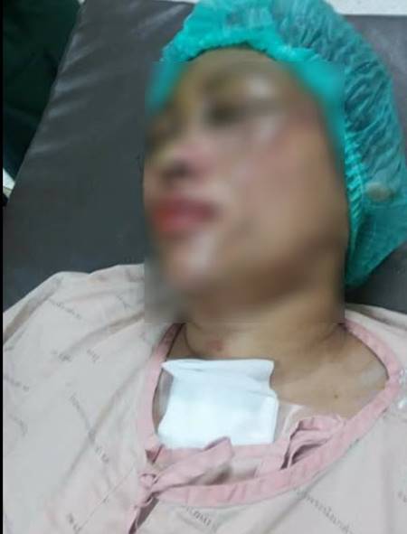 ดักสาดน้ำกรด