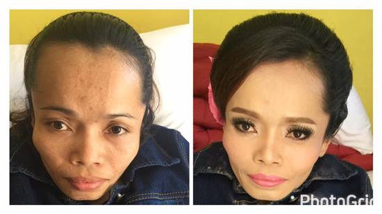 สาวพิการ ร่ำไห้ ชาวบ้านดูถูก-ด่าน่ารังเกียจ เพราะฝันอยากเป็นเจ้าสาว  