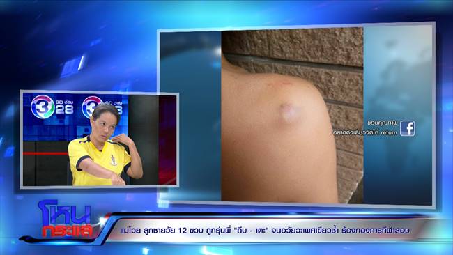 รุ่นพี่ทำร้าย