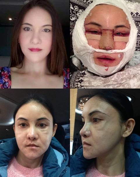 ศัลยกรรมทำพิษ