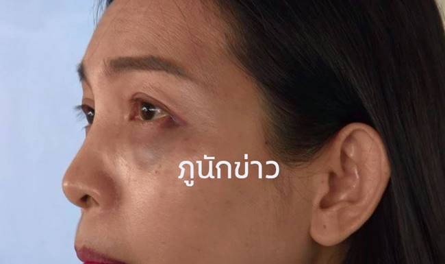 บีเอ็มต่อยครู