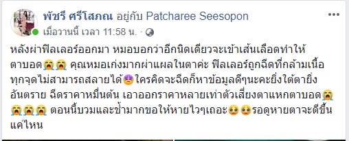 สาวฉีดฟิลเลอร์