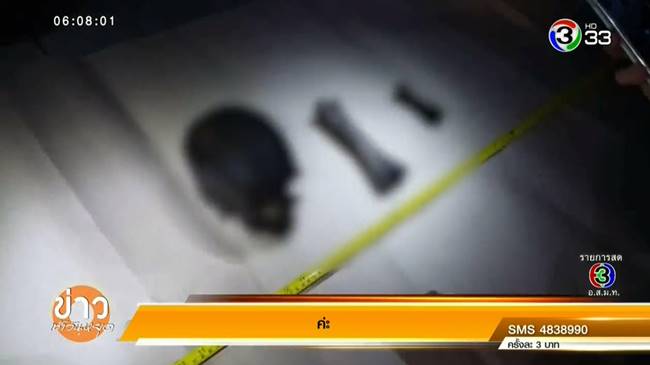 หัวกะโหลกคน