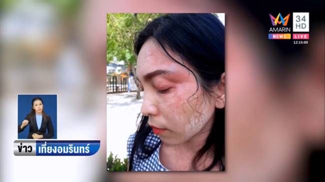 ต่อยหน้าครู