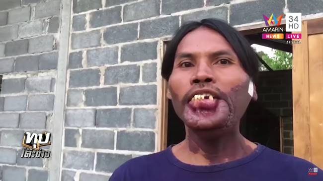 น้องบี มีมี่