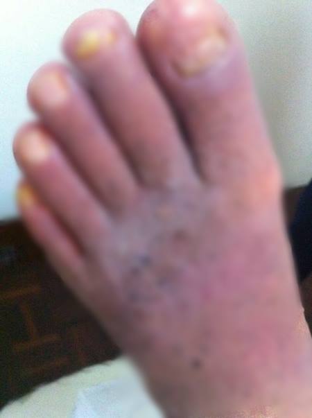 โชว์ภาพ พระธัมมชโย ป่วยหนัก แผลเหวอะ-ติดเชื้อรุนแรง วอนดีเอสไอเห็นใจ