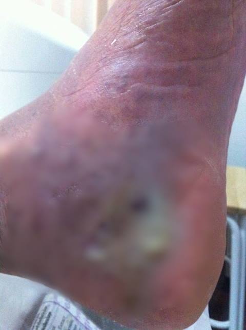 โชว์ภาพ พระธัมมชโย ป่วยหนัก แผลเหวอะ-ติดเชื้อรุนแรง วอนดีเอสไอเห็นใจ 