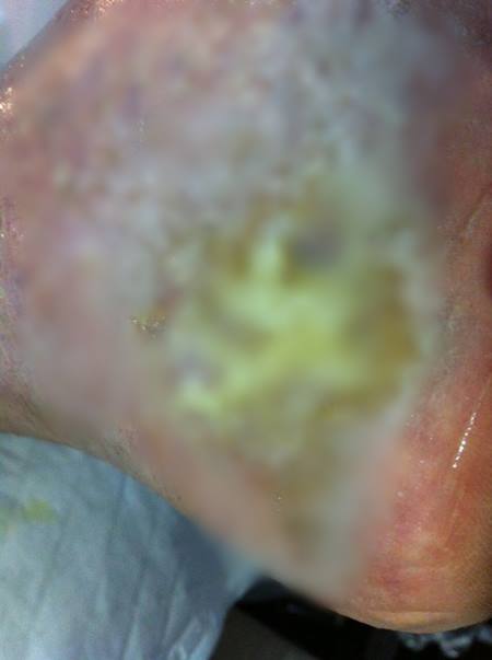 โชว์ภาพ พระธัมมชโย ป่วยหนัก แผลเหวอะ-ติดเชื้อรุนแรง วอนดีเอสไอเห็นใจ