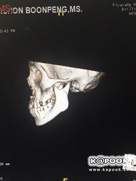 กานต์ เปิดโต๊ะแถลง ยัน ทอมบี ไม่เคยด่า เสก โลโซ