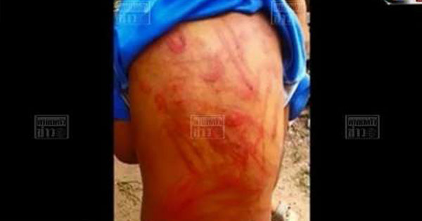 ยายเฆี่ยนหลาน 5 ขวบเนื้อแตก