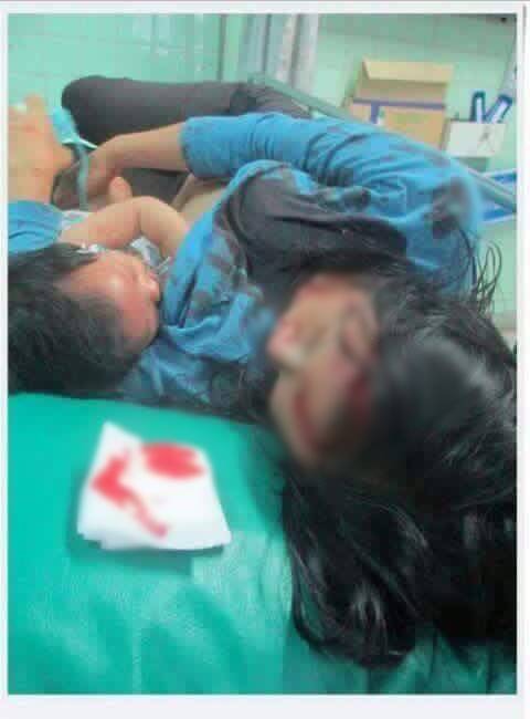 พลังแห่งรักของแม่..ประสบอุบัติเหตุเลือดอาบกาย แต่กอดให้นมลูกน้อยไม่ห่าง