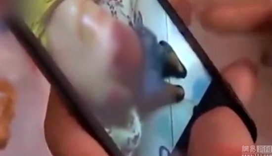 ครูอำมหิต คว้าด้ามไม้กวาดกระหน่ำฟาดก้นเด็กไม่ทำการบ้าน ผิวแตก-ห้อเลือดหนัก