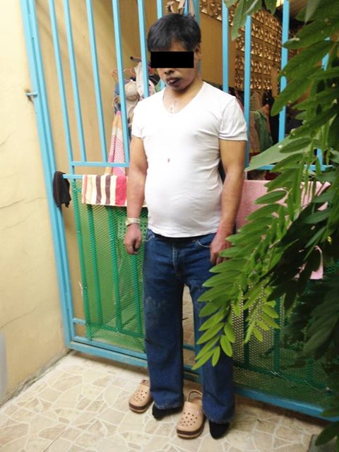 ชาวเน็ต กังขา สภาพศพ พ.ต.ท. จันทร์ ฟันหักหมดปาก เชื่อจัดฉากผูกคอตาย