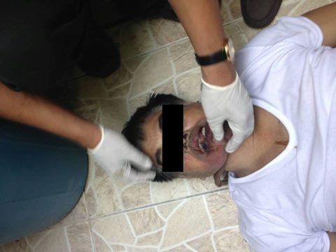 ชาวเน็ต กังขา สภาพศพ พ.ต.ท. จันทร์ ฟันหักหมดปาก เชื่อจัดฉากผูกคอตาย