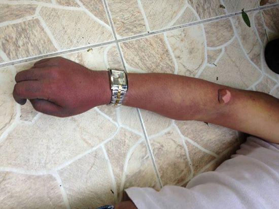 ชาวเน็ต กังขา สภาพศพ พ.ต.ท. จันทร์ ฟันหักหมดปาก เชื่อจัดฉากผูกคอตายชาวเน็ต กังขา สภาพศพ พ.ต.ท. จันทร์ ฟันหักหมดปาก เชื่อจัดฉากผูกคอตาย