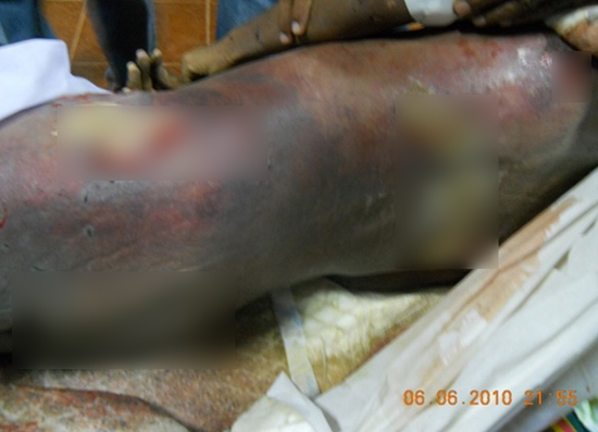 ทหารเกณฑ์ถูกซ้อมจนตายเมื่อ 4 ปีก่อน-คดีไม่คืบ ญาติขอสู้จนถึงที่สุด !