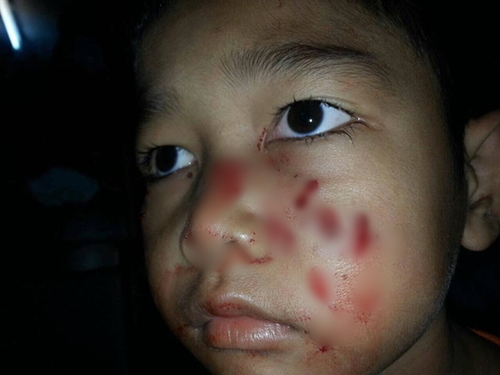 รอดหวุดหวิด แม่ช่วยลูกชายขณะงูเหลือมกำลังเขมือบอยู่บนเตียงกลางดึก