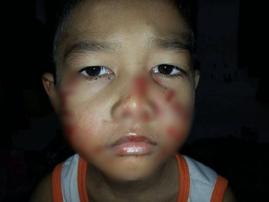 รอดหวุดหวิด แม่ช่วยลูกชายขณะงูเหลือมกำลังเขมือบอยู่บนเตียงกลางดึก