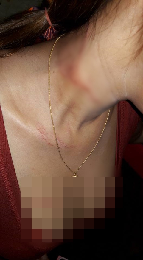 โพสต์เตือนภัย คนที่ชอบใส่ของมีค่าติดตัว