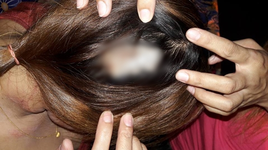 โพสต์เตือนภัย คนที่ชอบใส่ของมีค่าติดตัว