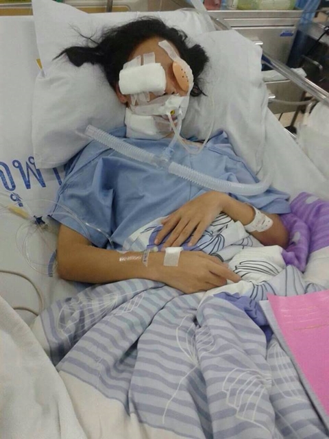 สาว ม.6 โดนยิงผิดตัว อนาคตดับวูบ ตาบอดสนิทสองข้าง