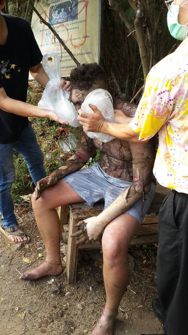 สลด ! น้องจีโน่ ที่ถูกลวงไปเผาทั้งเป็น ล่าสุดเสียชีวิตแล้ว