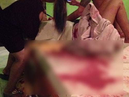 สาวเข้า รร.ม่านรูด กับแฟน เมาลื่นล้มฟาดโต๊ะกระจกเลือดสาด