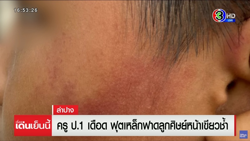ครูตีเด็กขอขมากับแม่เด็ก