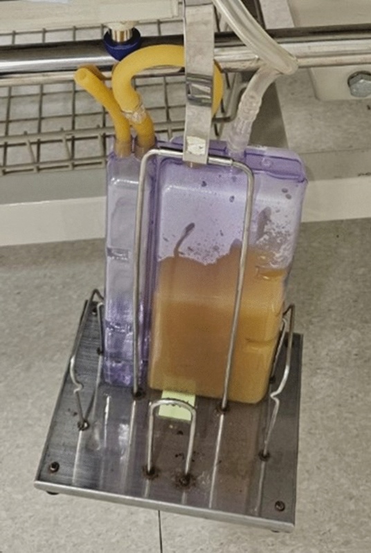 ปอดมีหนอง