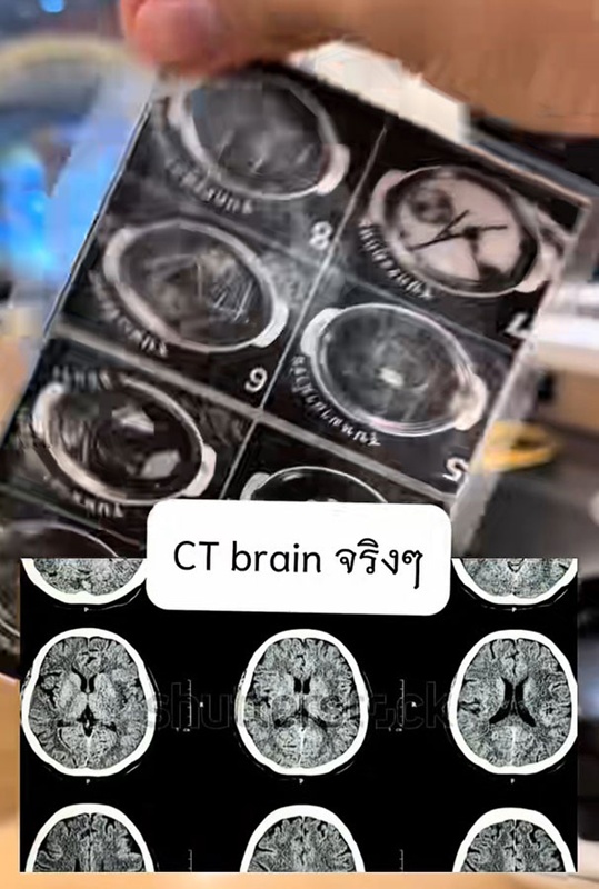 หมอไปกินชาบู เห็นภาพคุ้น ๆ