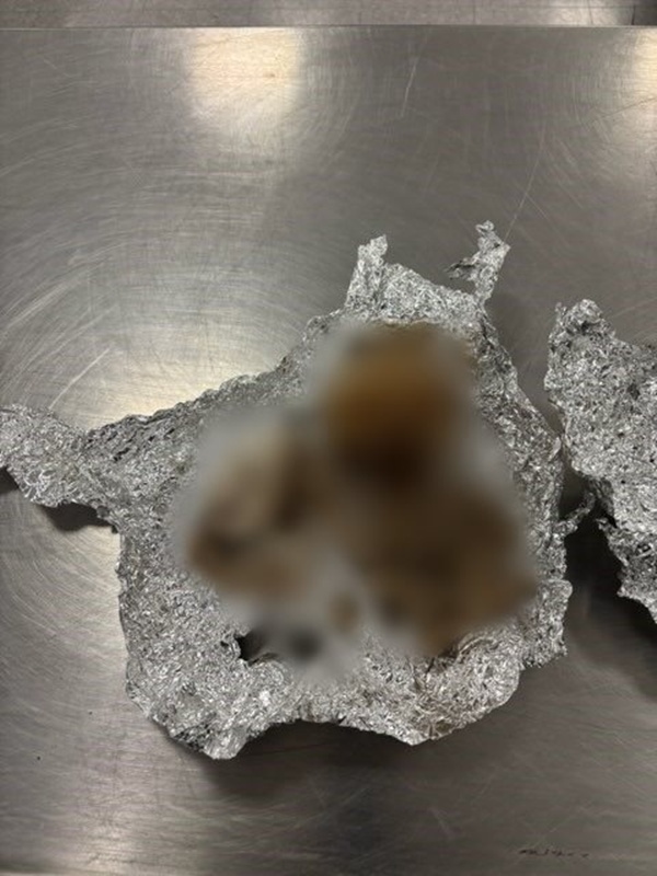 จนท. สนามบินช็อก ตรวจกระเป๋าเจอกระโหลก