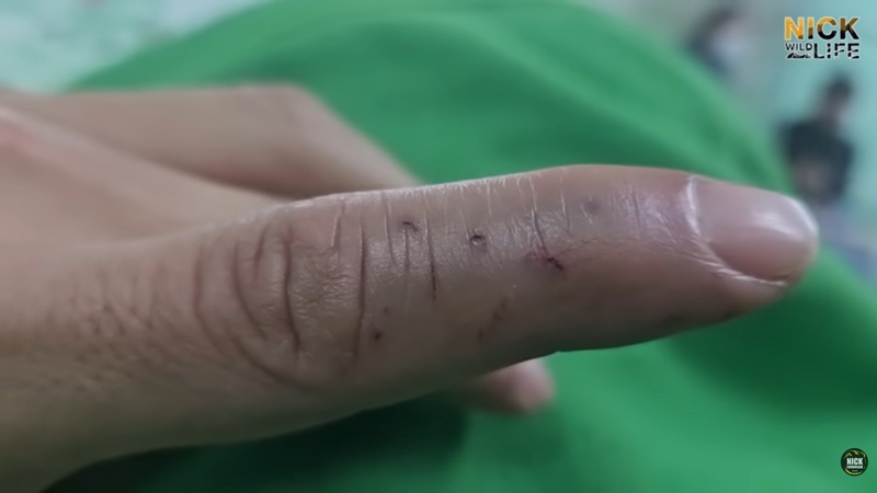 นิค Wildlife ผู้เชี่ยวชาญด้านงูถูกจงอางฉก