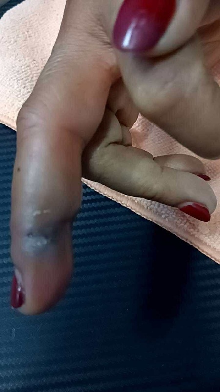 เตือนภัยจากกุ้ง