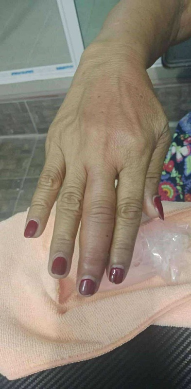 เตือนภัยจากกุ้ง