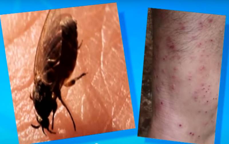 ตัวคุ่นกัด