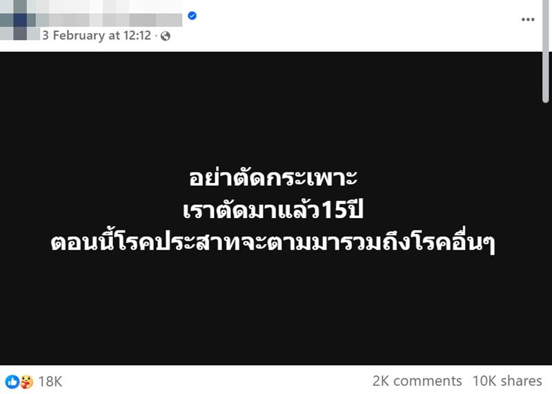 ตัดกระเพาะ