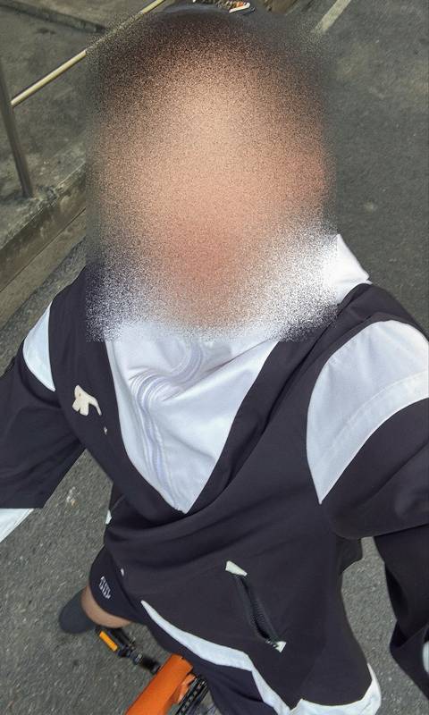 ตัดกระเพาะ