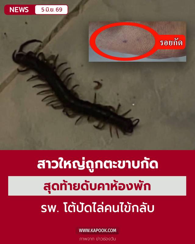 หญิงถูกตะขาบกัด