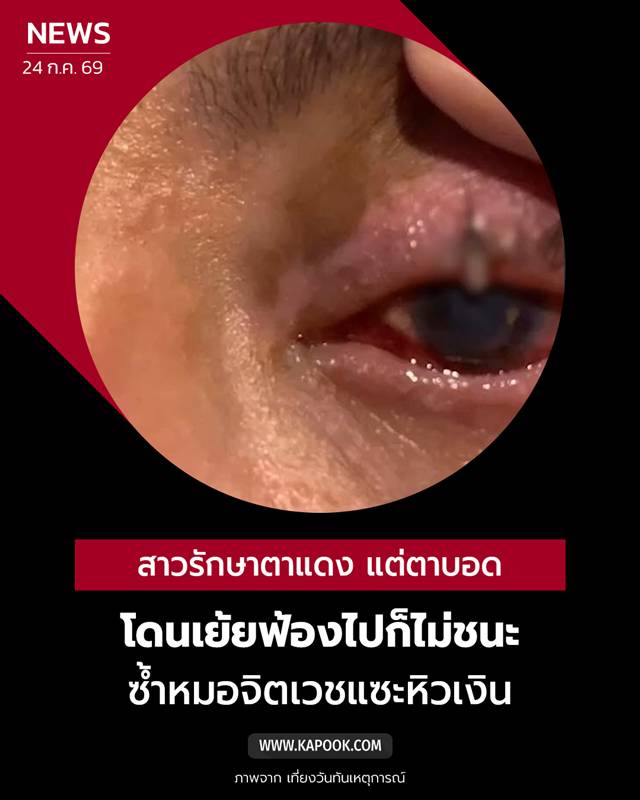 แพ้ยาตาบอด