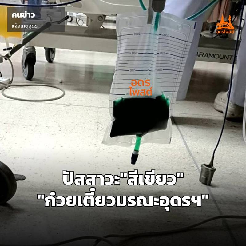 ปัสสาวะสีเขียว