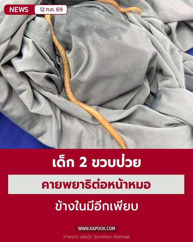 พยาธิในเด็ก 2 ขวบ