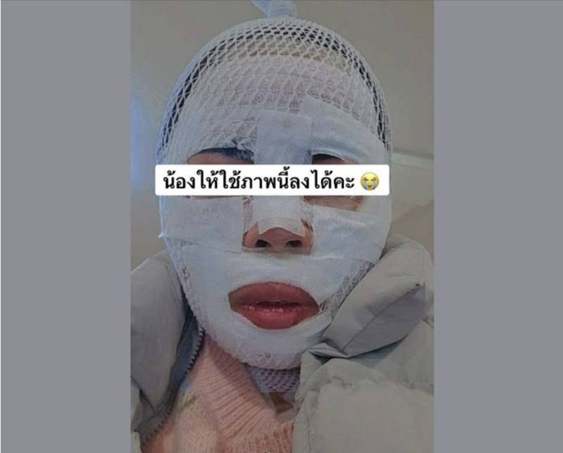 ทำร้ายร่างกาย