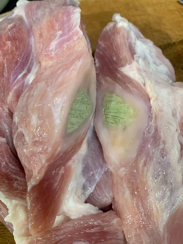 ฝีหนองหมู