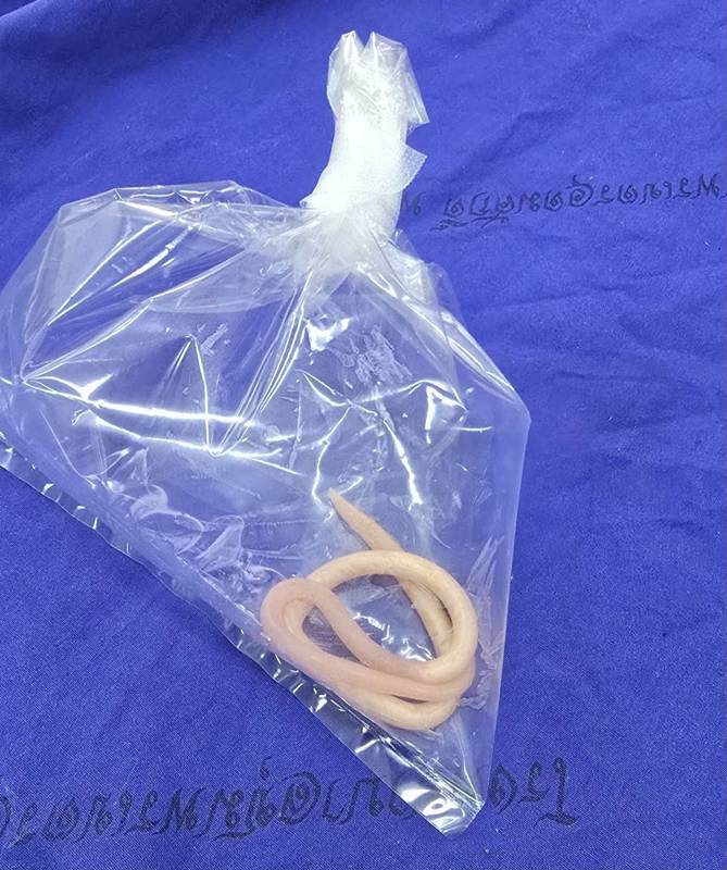 พยาธิในเด็ก 2 ขวบ